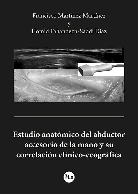 Estudio anat&oacute;mico del abductor accesorio de la mano y su correlaci&oacute;n cl&iacute;nico-ecogr&aacute;fica(Kobo/電子書)