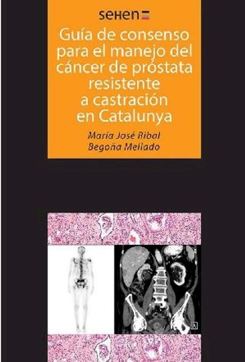 Gu&iacute;as de consenso para el manejo del c&aacute;ncer de pr&oacute;stata resistente a castraci&oacute;n en Catalunya(Kobo/電子書)