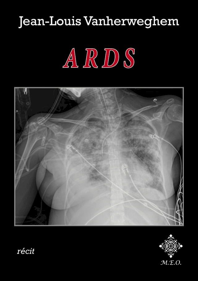  ARDS(Kobo/電子書)