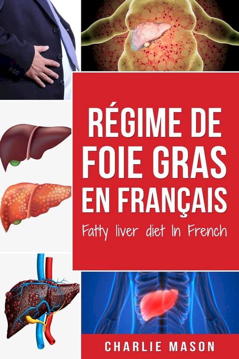 Régime de foie gras En français/ Fatty liver diet In French(Kobo/電子書)