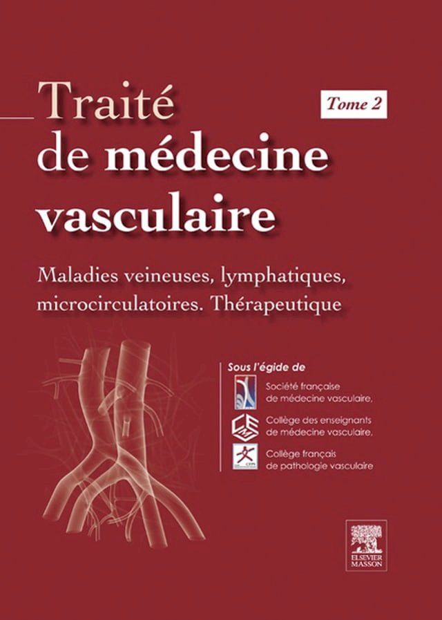  Traité de médecine vasculaire. Tome 2(Kobo/電子書)