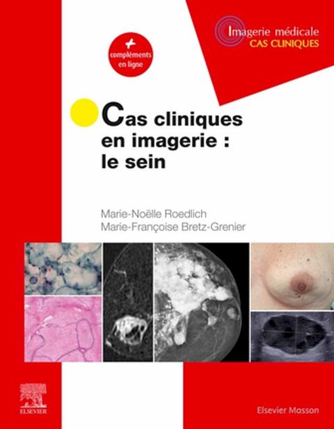 Cas cliniques en imagerie : le sein(Kobo/電子書)