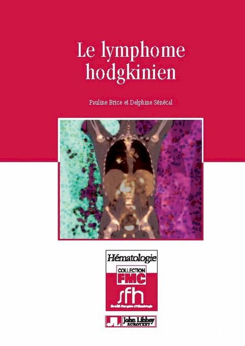 Le lymphome hodgkinien(Kobo/電子書)