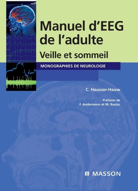 Manuel d'EEG de l'adulte(Kobo/電子書)