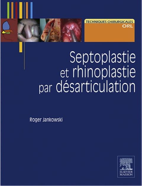 Septoplastie et rhinoplastie par d&eacute;sarticulation(Kobo/電子書)