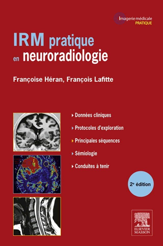  IRM pratique en neuroradiologie(Kobo/電子書)