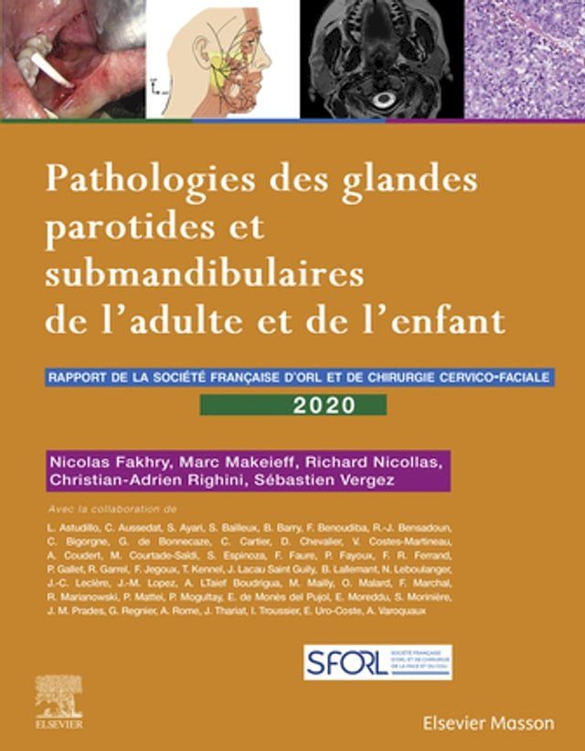  Pathologies des glandes parotides et submandibulaires de l'adulte et de l'enfant(Kobo/電子書)