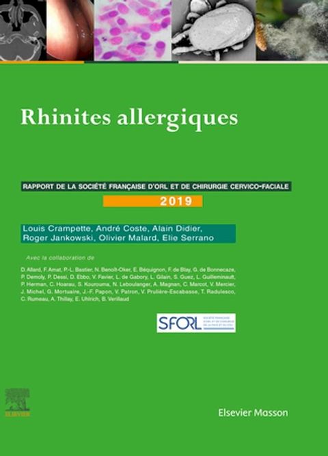 Rhinites allergiques(Kobo/電子書)