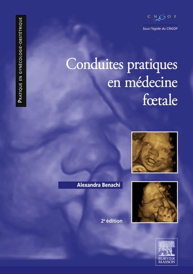  Conduites pratiques en médecine foetale(Kobo/電子書)