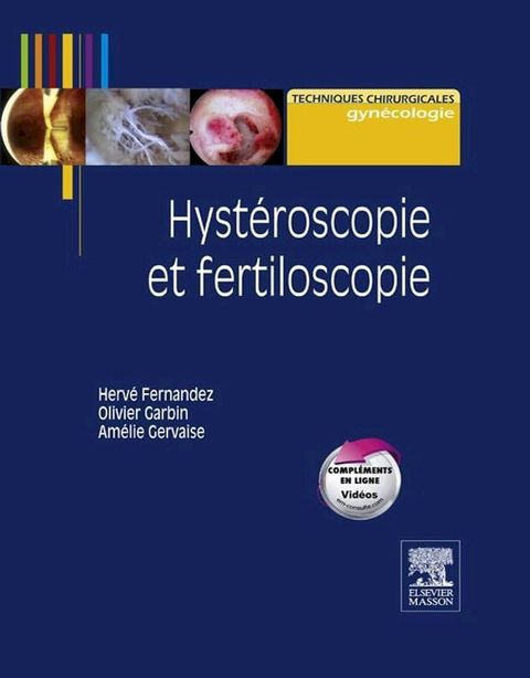 Hyst&eacute;roscopie et fertiloscopie(Kobo/電子書)