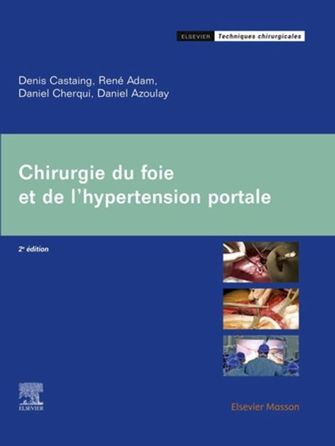 Chirurgie du foie et de l'hypertension portale(Kobo/電子書)