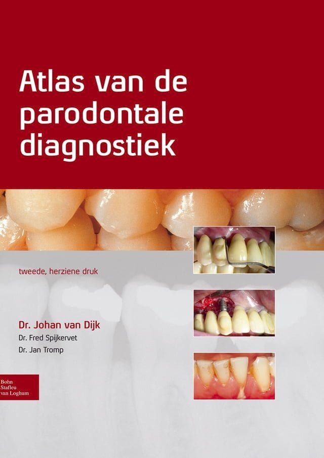  Atlas van de parodontale diagnostiek(Kobo/電子書)