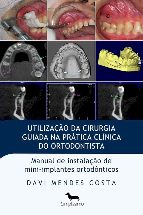 Utilização da cirurgia guiada na prática clínica do ortodontista(Kobo/電子書)