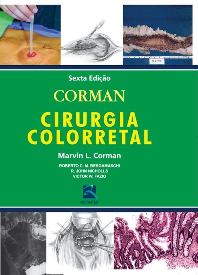  Corman – Cirurgia Colorretal(Kobo/電子書)