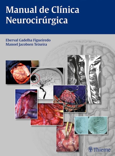 Manual de clínica neurocirúrgica(Kobo/電子書)