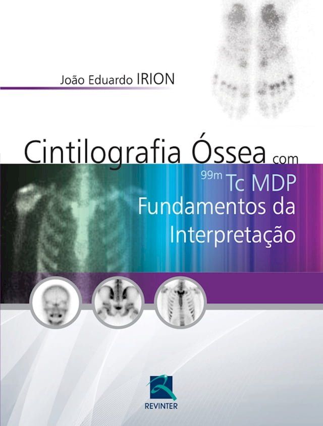  Cintilografia óssea com 99mTc MDP(Kobo/電子書)