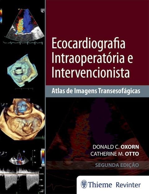 Ecocardiografia Intraoperat&oacute;ria e Intervencionista(Kobo/電子書)