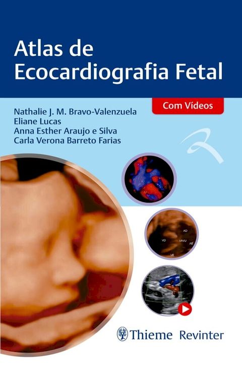 Atlas de Ecocardiografia Fetal(Kobo/電子書)