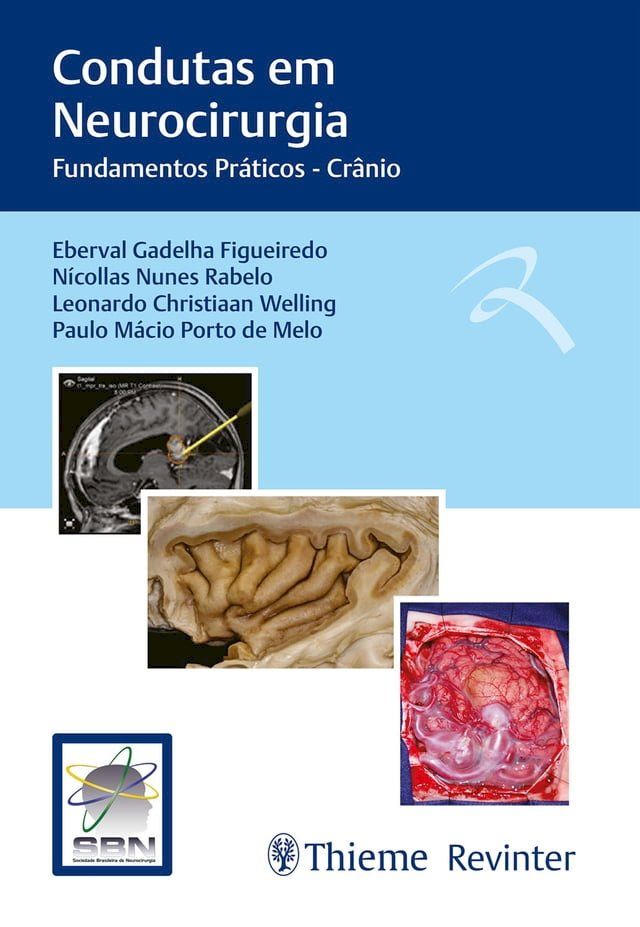  Condutas em Neurocirurgia(Kobo/電子書)