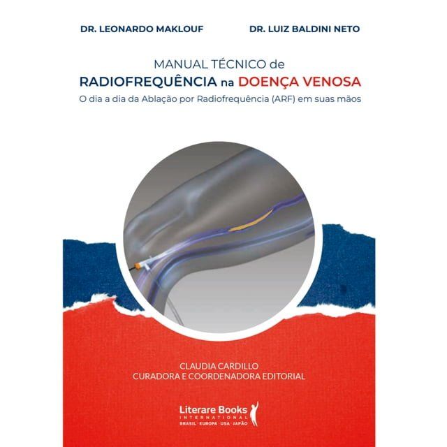  Manual t&eacute;cnico de radiofrequ&ecirc;ncia na doen&ccedil;a venosa(Kobo/電子書)