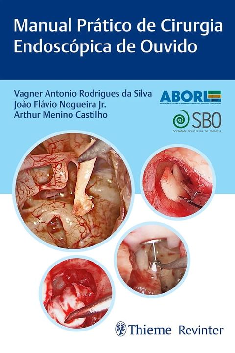 Manual Prático de Cirurgia Endoscópica de Ouvido(Kobo/電子書)