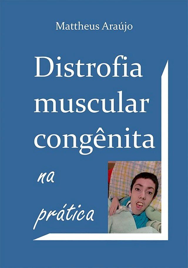  Distrofia Muscular Cong&ecirc;nita Na Pr&aacute;tica(Kobo/電子書)