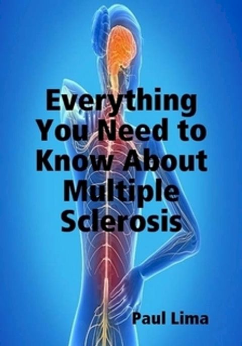 Everything You Need to Know about Multiple Sclerosis(Kobo/電子書)