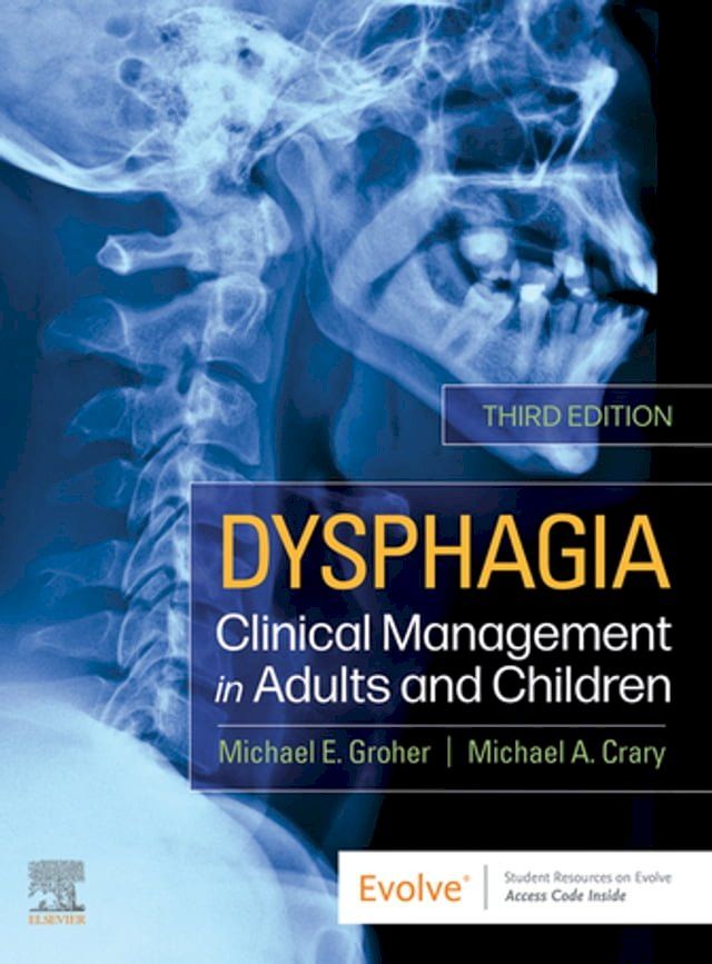  Dysphagia - E-Book(Kobo/電子書)