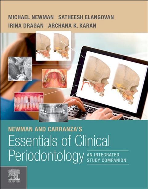 Newman and Carranza's Essentials of Clinical Periodontology(Kobo/電子書)