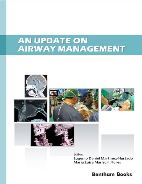 An Update on Airway Management(Kobo/電子書)