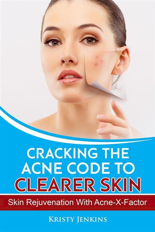  Cracking the Acne Code to Clearer Skin(Kobo/電子書)