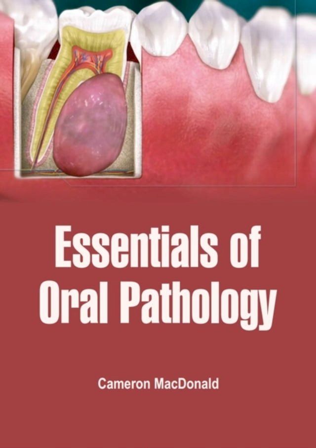  Essentials of Oral Pathology(Kobo/電子書)