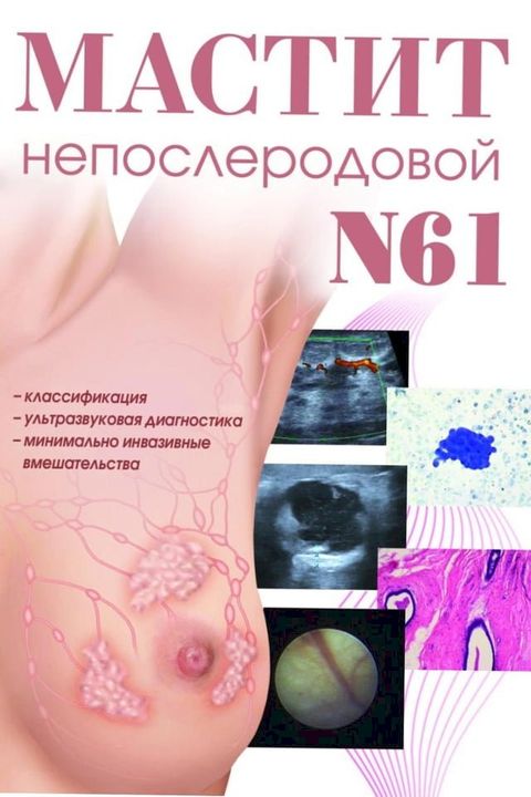 Мастит непослеродовой N61(Kobo/電子書)