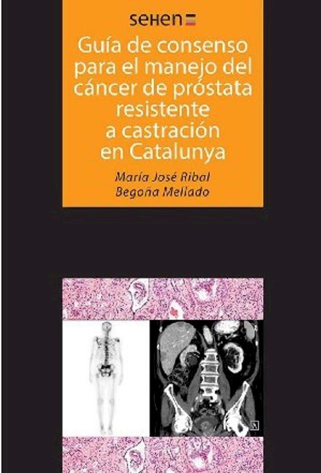  Guía de consenso para el manejo del cáncer de próstata resistente a castración en Catalunya(Kobo/電子書)