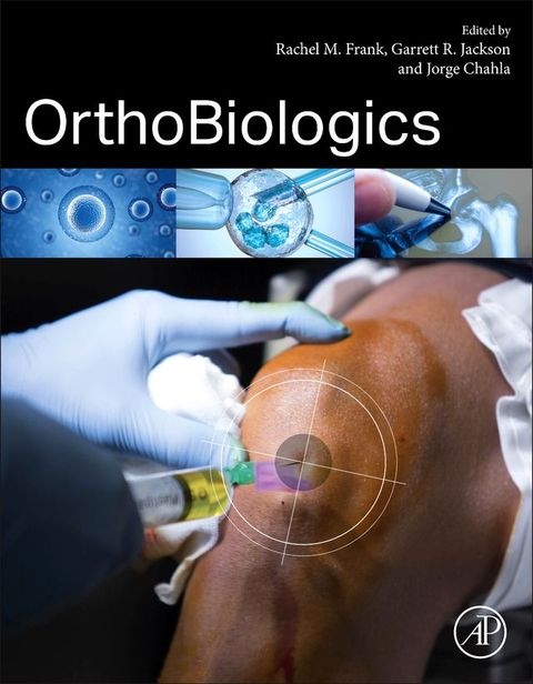 OrthoBiologics(Kobo/電子書)