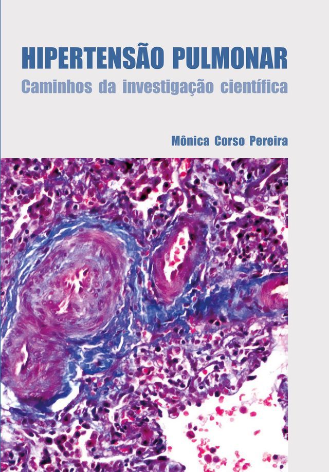  Hipertensão pulmonar(Kobo/電子書)