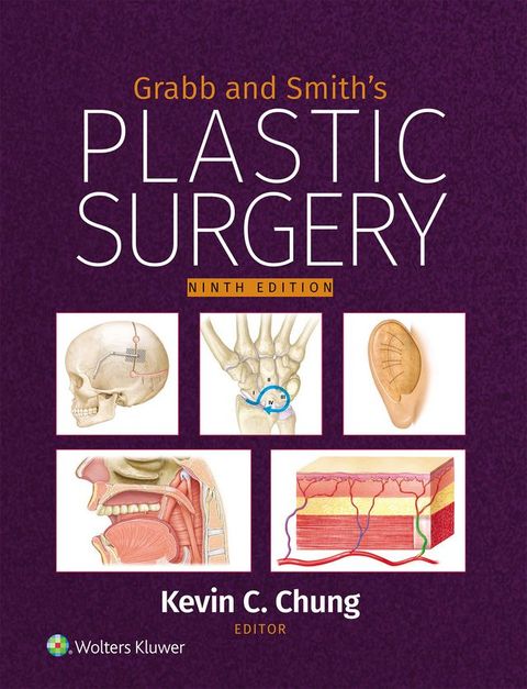 Grabb and Smith's Plastic Surgery: eBook with Multimedia(Kobo/電子書)