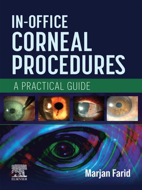 In-Office Corneal Procedures(Kobo/電子書)