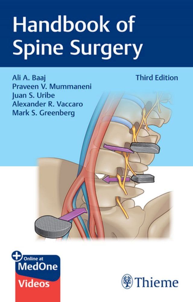  Handbook of Spine Surgery(Kobo/電子書)