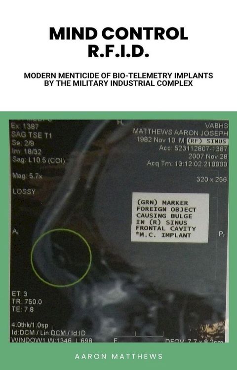 Mind Control R.F.I.D. Modern Menticide of Bio-Telemetry Implants by the Military Industrial Complex(Kobo/電子書)