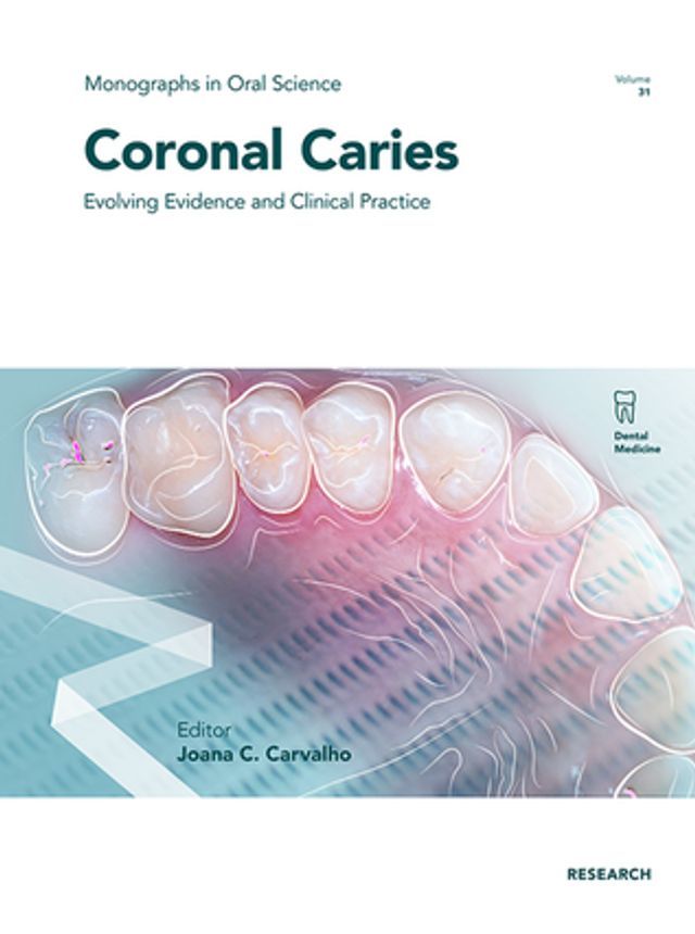  Coronal Caries(Kobo/電子書)