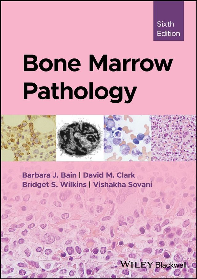  Bone Marrow Pathology(Kobo/電子書)