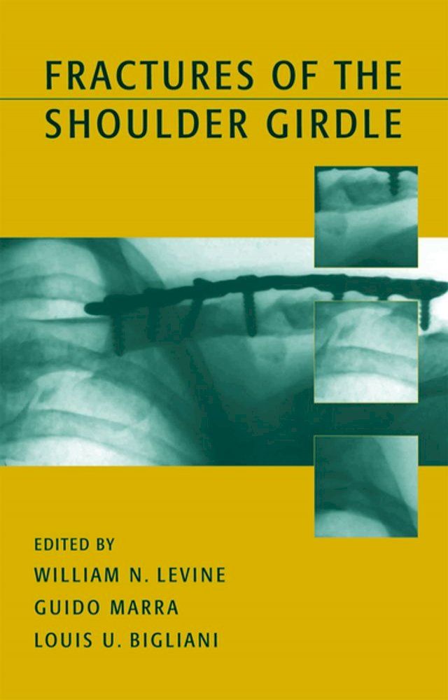  Fractures of the Shoulder Girdle(Kobo/電子書)