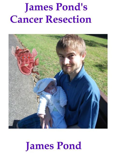James Pond's Cancer Resection