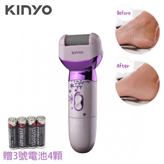 KINYO  便攜電池式去角質美足機 去硬皮磨腳機 美足清潔機 去腳皮機
