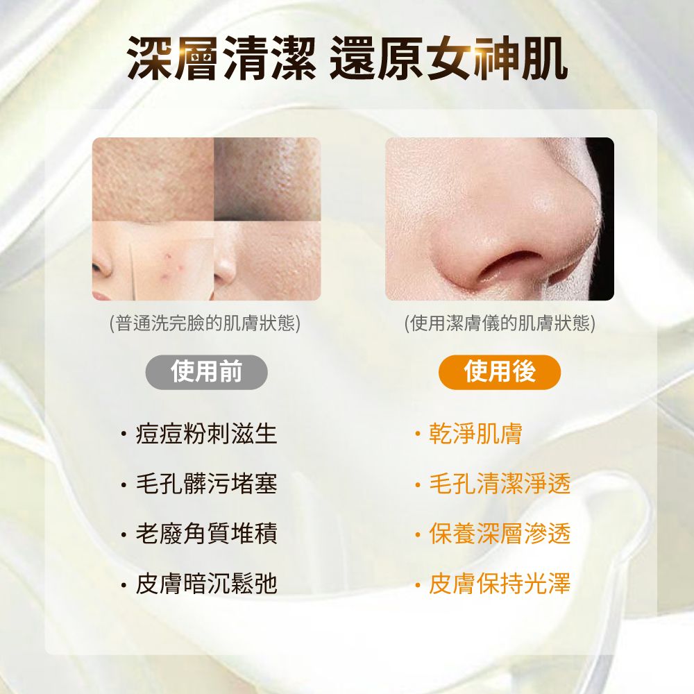 奧緹 【Obeauty 】金盞花粉刺毛孔潔膚儀-溫和震動音波深層清潔-按摩拉提輪廓(UFS-130)