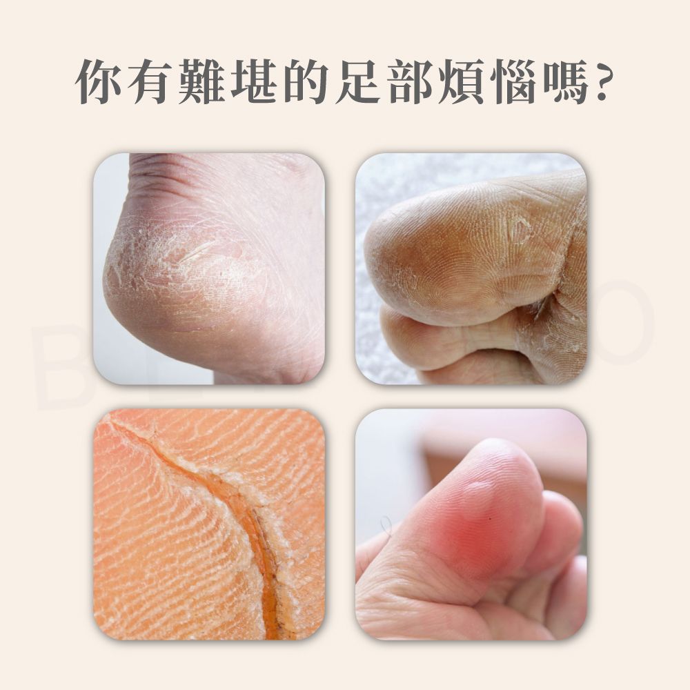 B你有難堪的足部煩惱嗎?