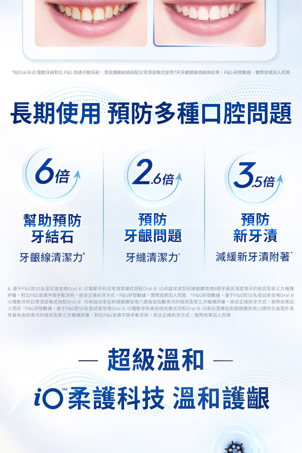 *指OralB 電動牙刷對比 P&G 普通手動牙刷,清潔護齦刷頭搭配日常清潔模式使用7天牙齦健康值檢測結果,P&G 研發數據,實際效果因人而異長期使用 多種口腔問題6倍35倍个幫助牙齦問題新牙漬牙齦線清潔力牙縫清潔力減緩新牙漬附著& 基于P&G對55名受試者使用Oral-電動牙刷日常清潔模式搭配Oral-BO卓越深潔型刷頭連續使用8牙菌斑清潔情况的檢測及第三方機構評審,對比P&G普通平頭手動牙刷,結合正確刷牙方式,P&G研發數據,實際效果因人而異 P&G研發數據,基于P&G對55名受試者使用Oral-B電動牙刷日常清潔模式搭配Oral-B iO卓越深潔型刷頭連續使用八週菌斑指數情况的檢測及第三方機構評審,結合正確刷牙方式,實際效果因人而异 *P&G研發數據,基于P&G對50名受試者使用Oral-BO電動牙刷美白抛光模式搭配Oral-BO美白至臻型刷頭連續使用12週部分齒面外源性著色去除情况的檢測及第三方機構評審,對比P&G普通平頭手動牙刷,結合正確刷牙方式,實際效果因人而異- 超級溫和 iO柔護科技 溫和護齦