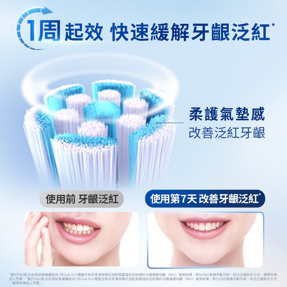 Oral-B 歐樂B iO2 微震科技電動牙刷 (兩色可選)