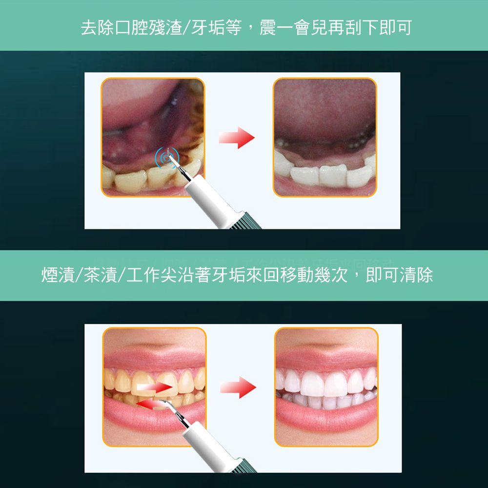 CS22 智能超聲波牙垢去除洗牙器2色